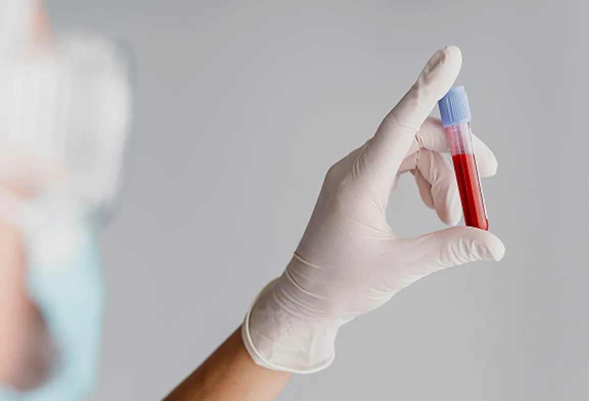 Анализы, Check-up